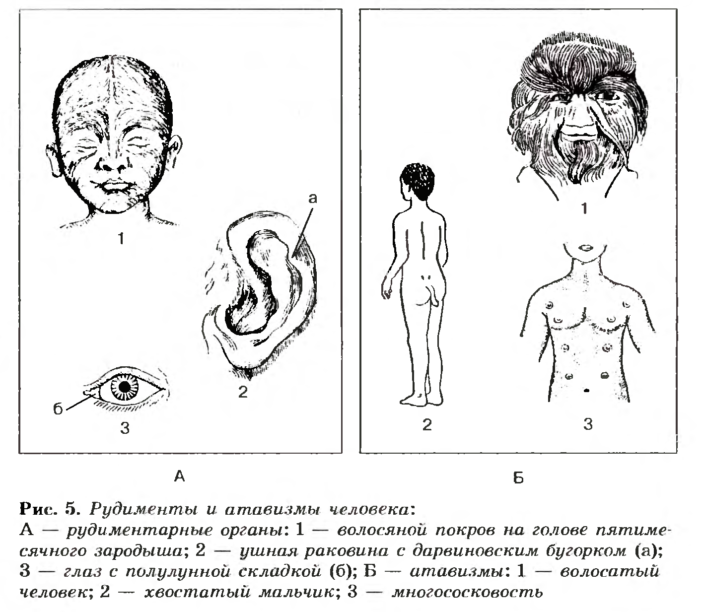 Рудименты и атавизмы человека
