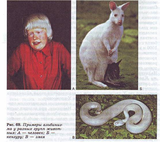 Альбинизм